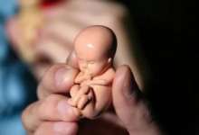 لزوم آگاهی مادر از وضعیت رشد جنین با غربالگری دوران بارداری