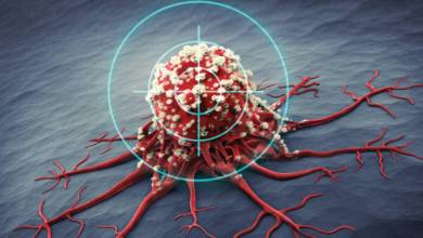 زنگ خطری به نام Cancer