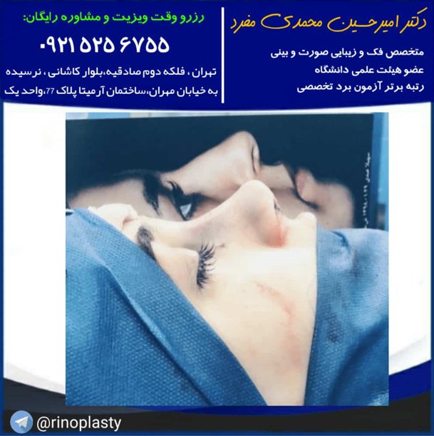 آیا جراحی بینی گوشتی است؟