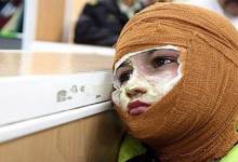 پوست دچار سوختگی «ترمیم» کامل نمی شود