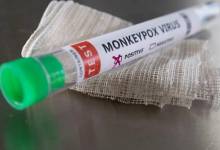 تامین کیت‌های غربالگری آبله میمونی در انستیتو پاستور/توزیع کیت‌های اولیه در آزمایشگاه‌های منتخب