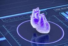 پیش‌بینی حمله قلبی با بررسی عکس رادیولوژی