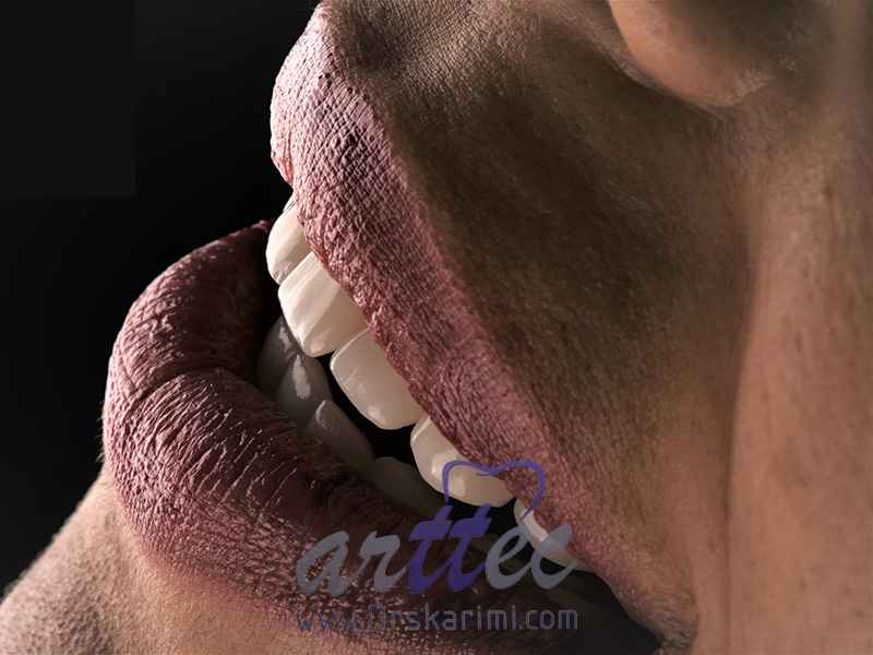 What is the difference between orthodontics and laser and dental laminate