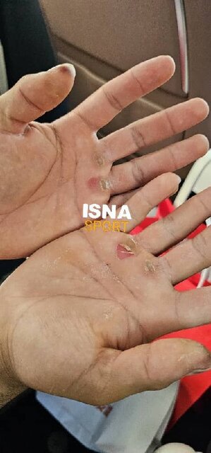 علت غیبت قهرمان جهان در اردوی تیم ملی وزنه‌برداری